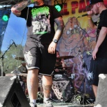DSC_6012-EPICARDIECTOMY