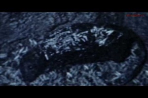 Krvavá neděle: REGURGITATE – „(We Are) Sadistic Hateful Scum“